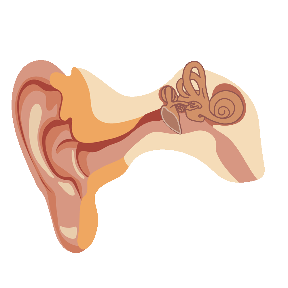 Types of Hearing Loss | ihear